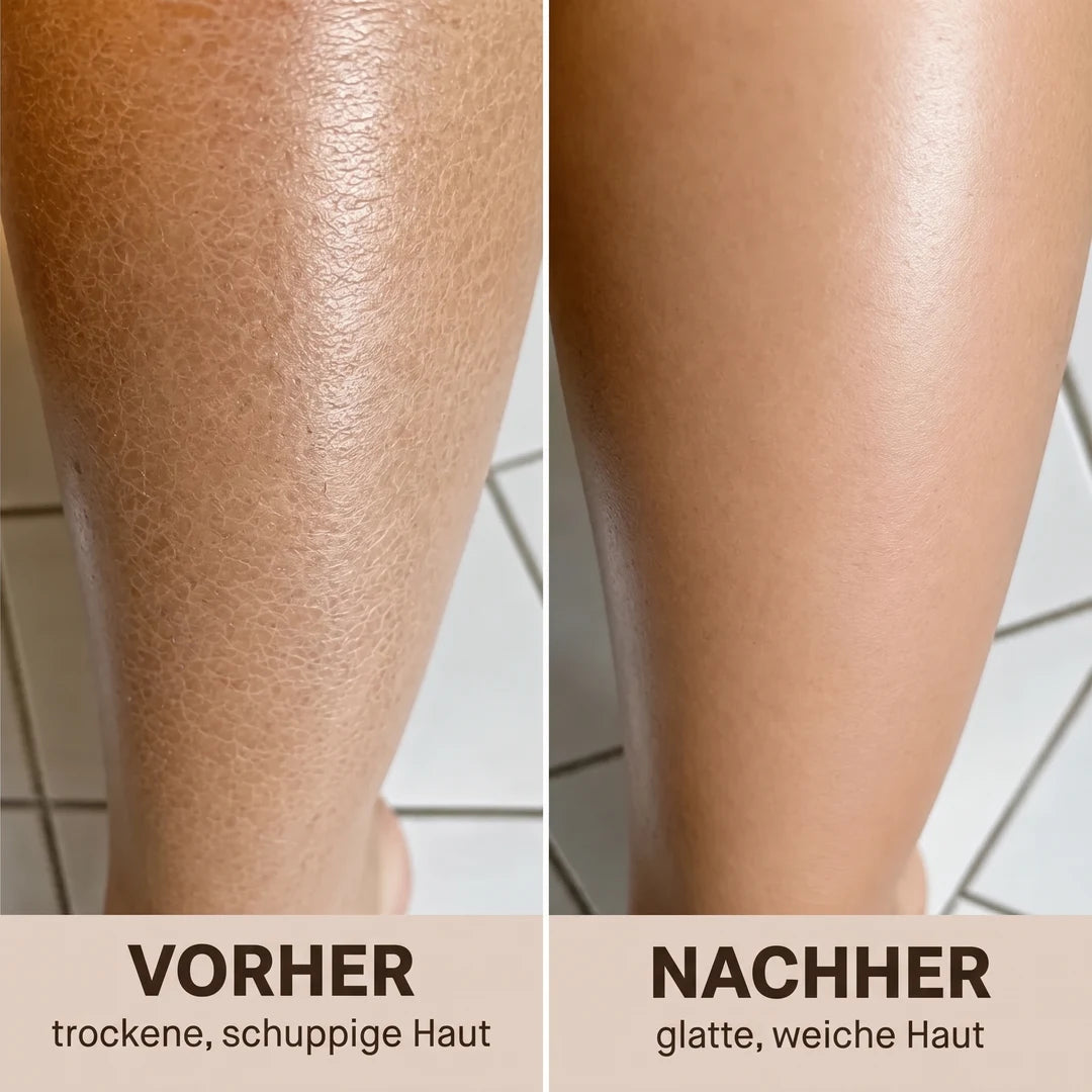 Vorher und nachher: trockene, schuppige Haut und glatte, weiche Haut